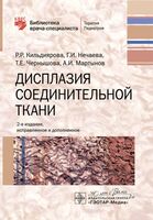 Дисплазия соединительной ткани